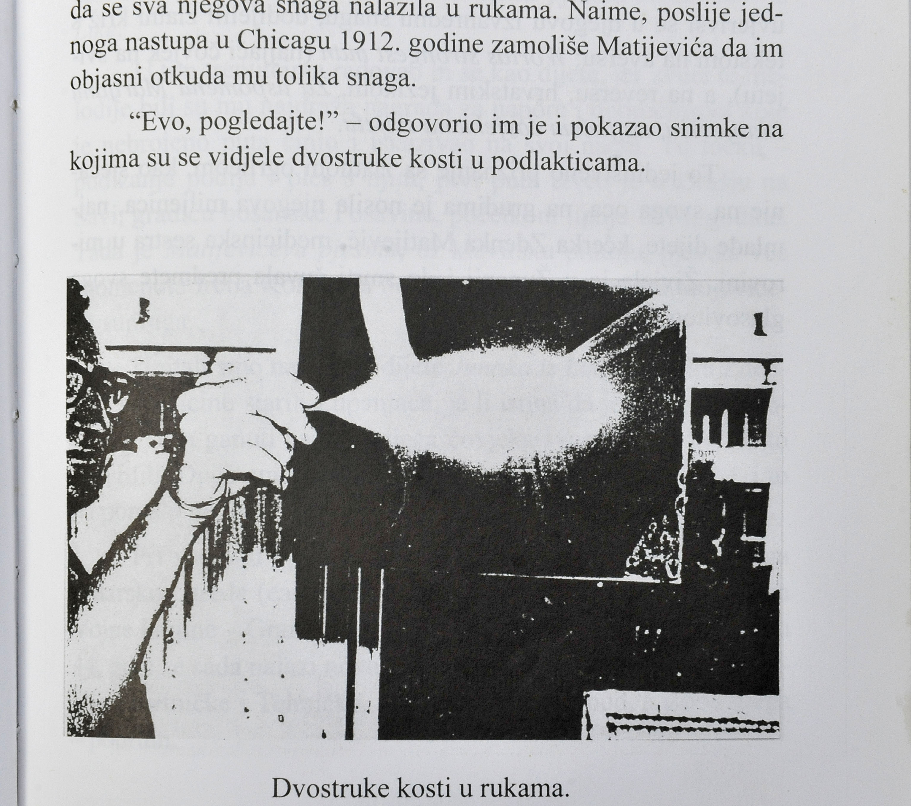 U Budimpešti mu je slomljena desna ruka
