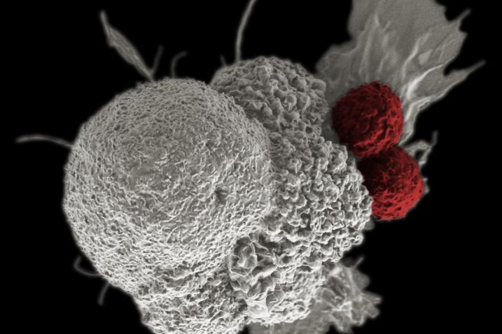 Kod raka dojke do sada nije zabilježen ovakav uspjeh liječenja imunoterapijom / Reuters