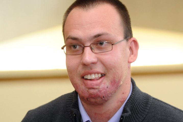 Presudom Općinskog radnog suda je državi i gradu Šibeniku naloženo da jedinom preživjelom vatrogascu kornatske tragedije Frani Lučiću isplati 1,75 milijuna kuna /  Snimio  Denis Lovrović