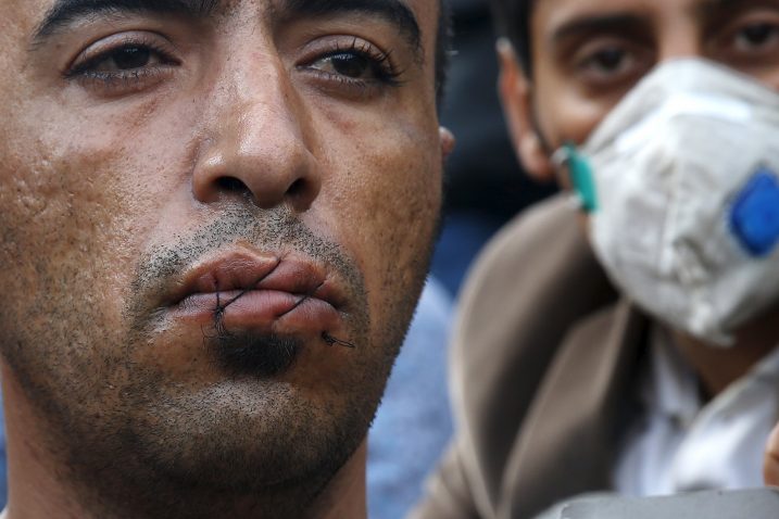 Iranac koji si je u znak rposvjeda zašio usne / Reuters