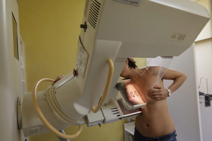 Prvi mamografski pregled trebalo bi obaviti između 38. i 40. godine / Foto Reuters