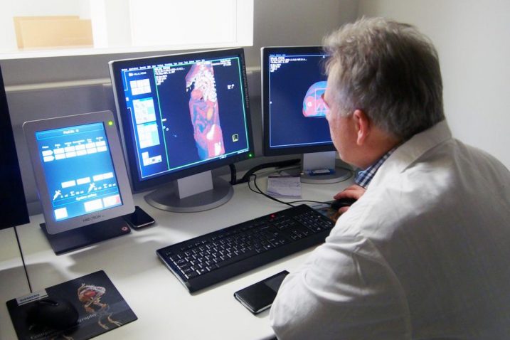 Najsuvremenija tehnologija u privatnoj klinici Radiochirurgia Zagreb