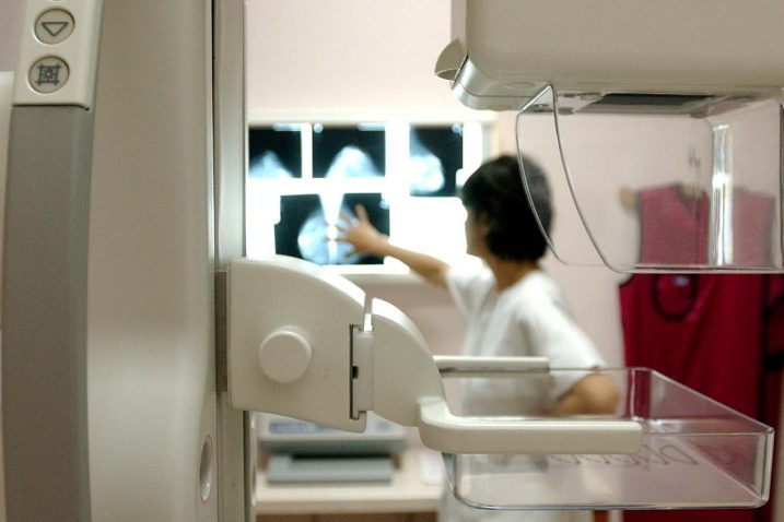 Iz KBC-a pacijentice se usmjeravaju u Centar Doma zdravlja koji od idućeg tjedna raspolaže digitalnim mamografom / NL arhiva