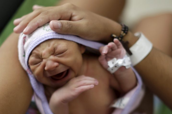 Novorođenče s mikrocefalijom rođeno u Brazilu / Foto Reuters