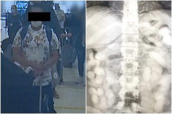Brazilka uhvaćena ranije u listopadu u zračnoj luci u Zagrebu i snimka rendgena na kojoj se vide paketići kokaina / Foto Screenshot Nova TV