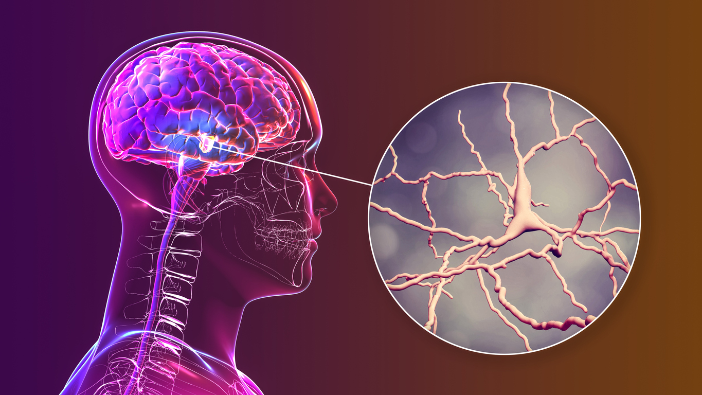 Foto: iStock