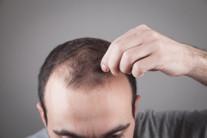 Foto: iStock