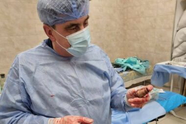 Kirurg Andrii Verba drži granatu nakon operacije / Foto facebook