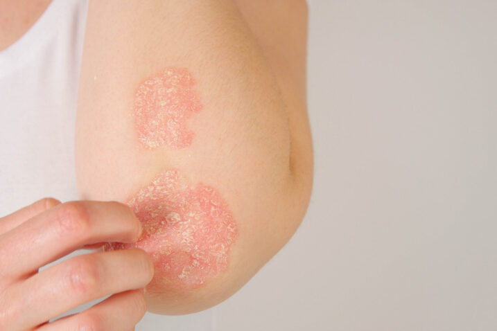 Foto: iStock