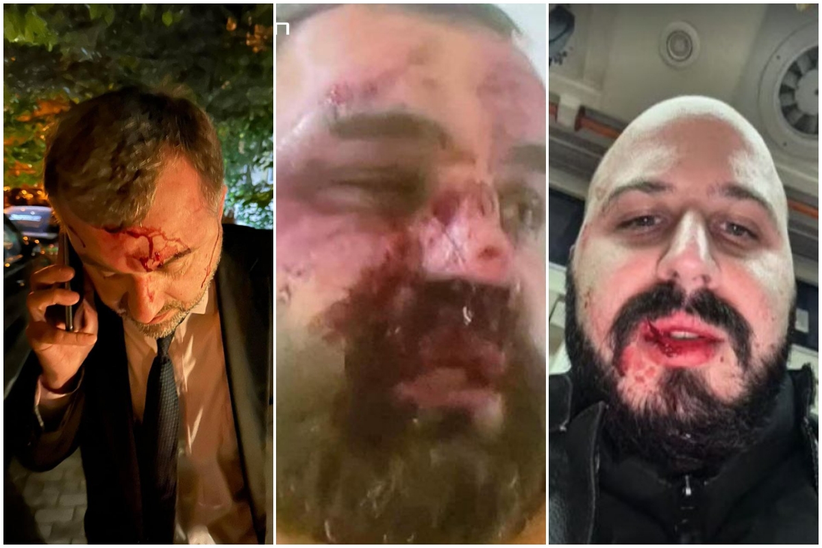 Vođe gruzijske oporbe, brutalno pretučeni u napadu nasilnika koje je angažirao vladajući režim / Foto Screenshot Twitter