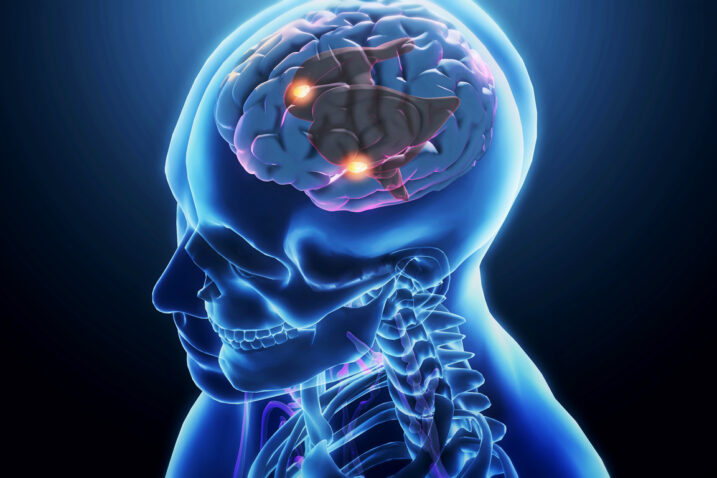 iStock