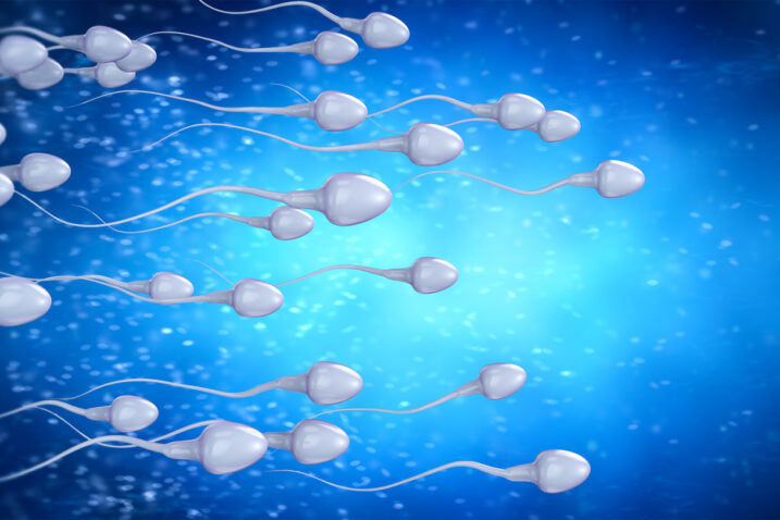iStock