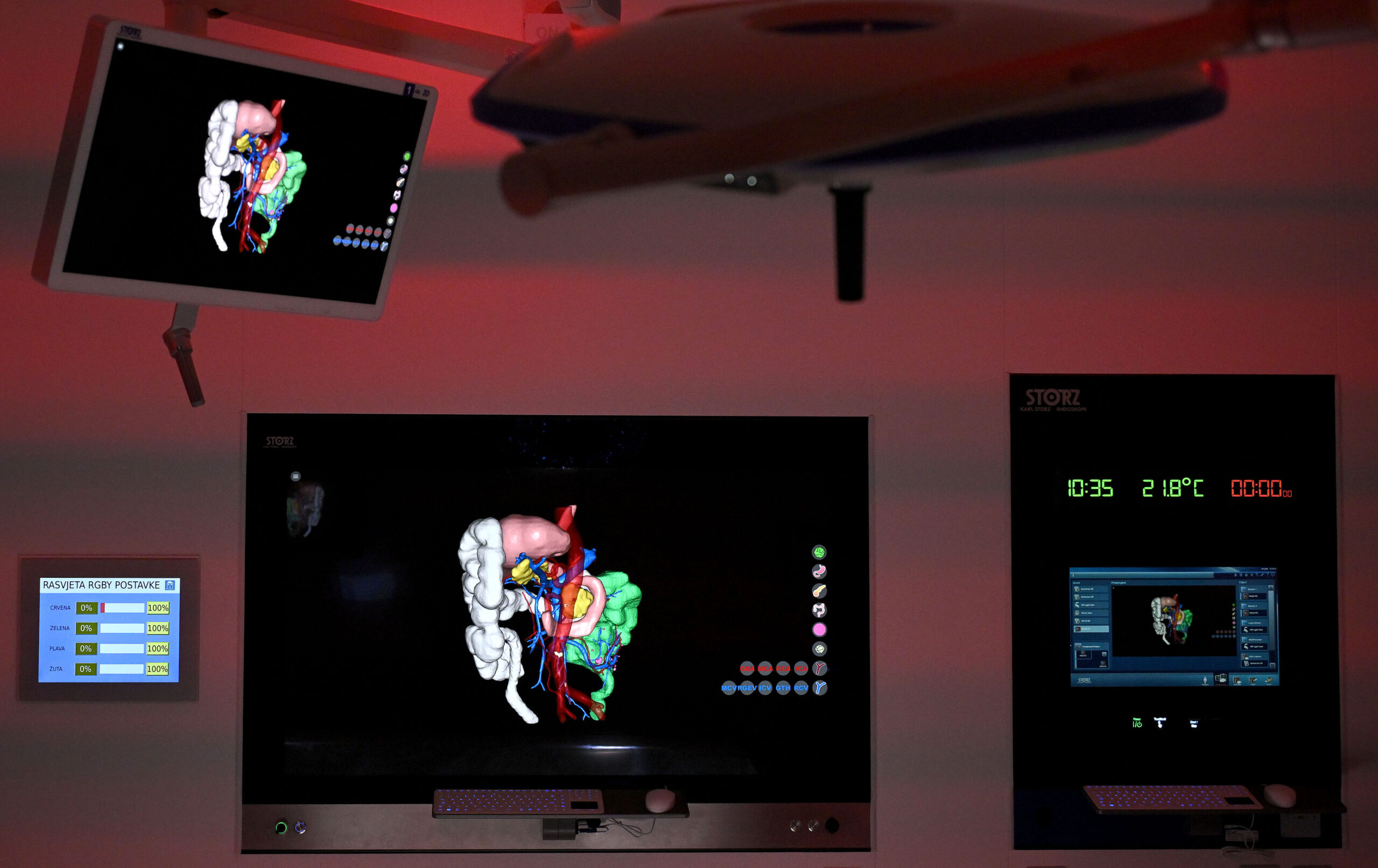 Nova operacijska sala s vrhunskom robotskom tehnologijom u KBC Zagreb / Foto: Marko Lukunić / PIXSELL