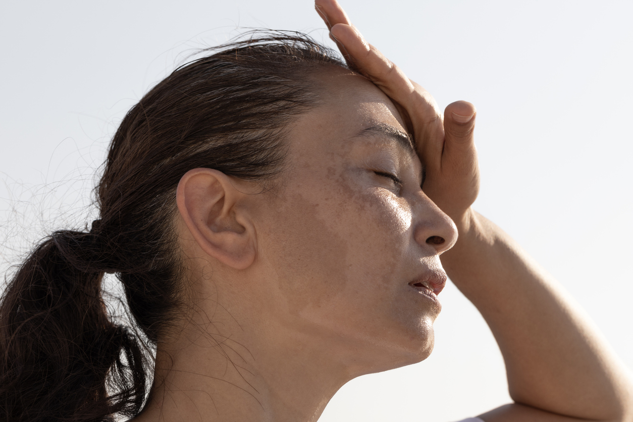 FOTO: iStock