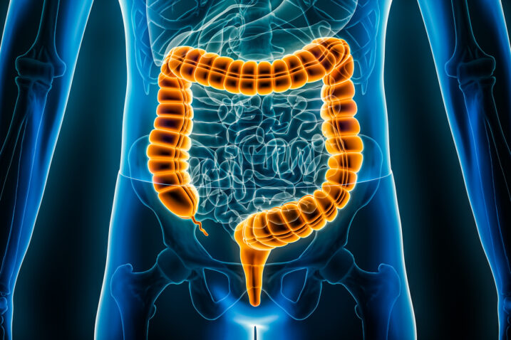 Foto: iStock