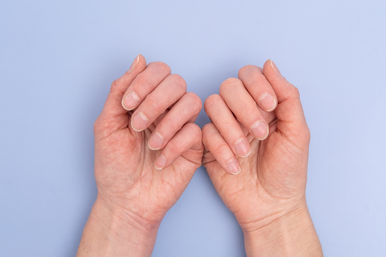 FOTO: iStock