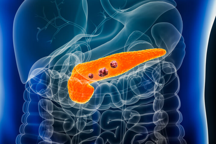 iStock