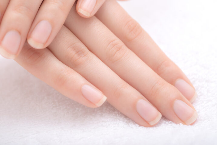 FOTO: iStock