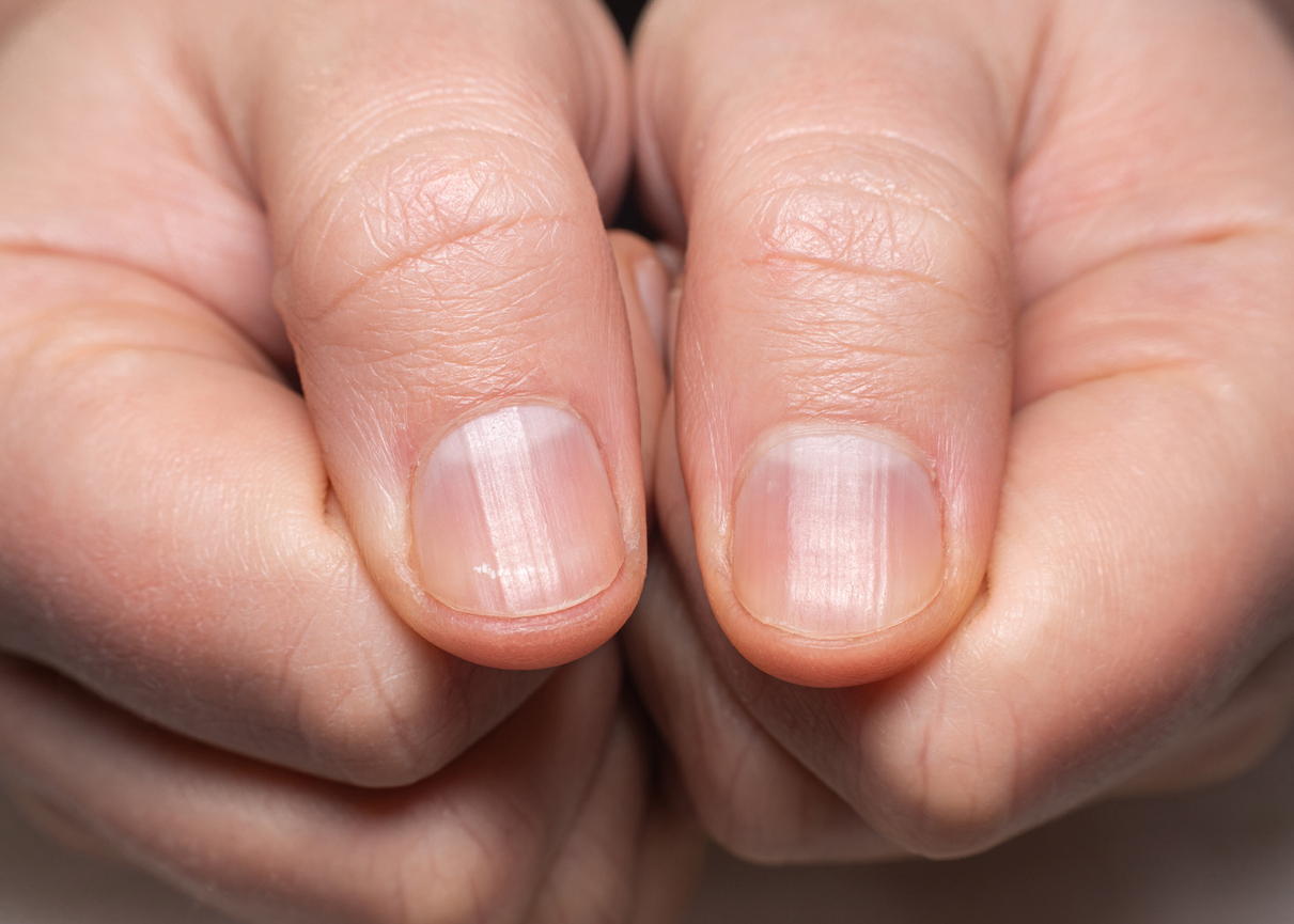 FOTO: iStock