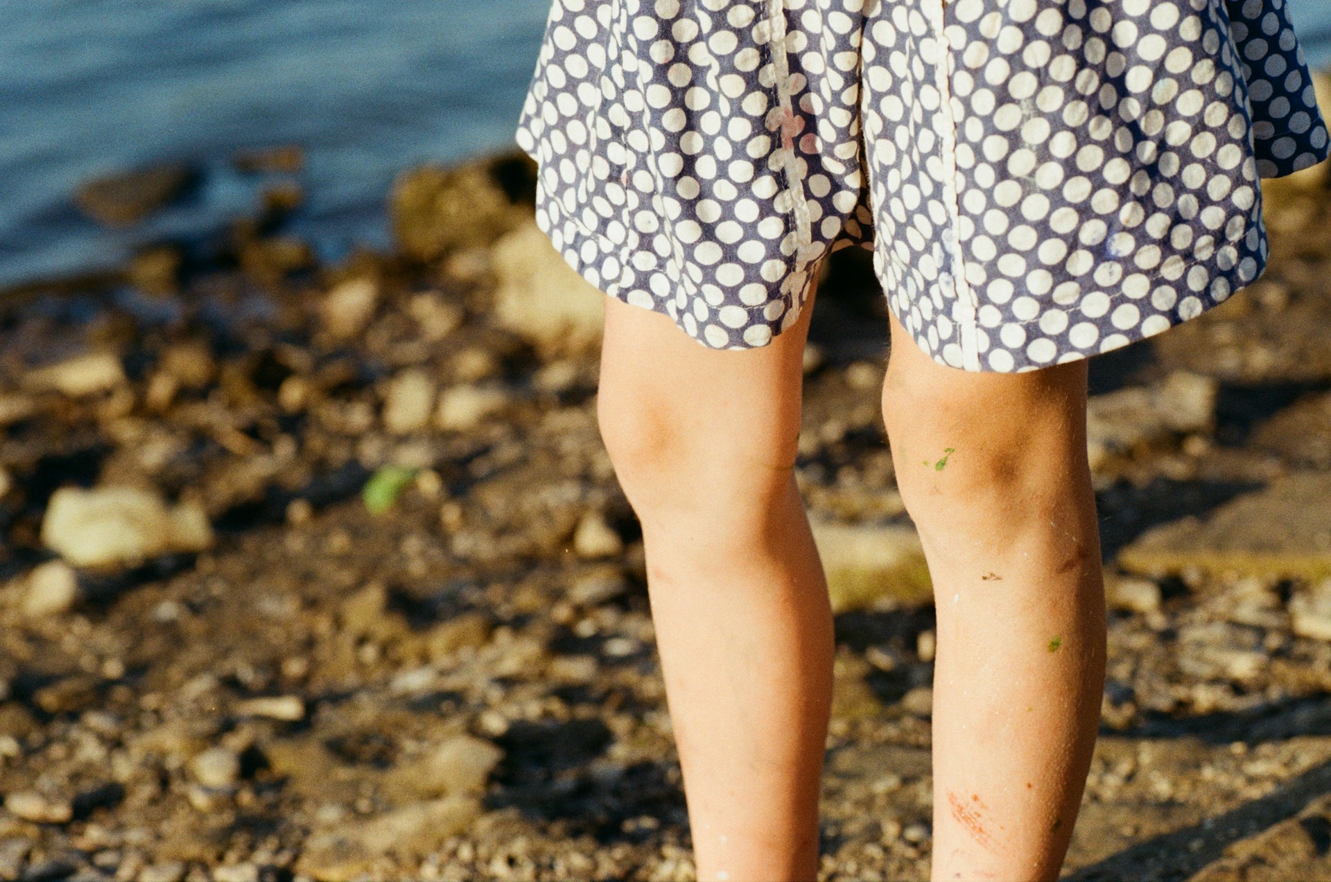 FOTO: Unsplash