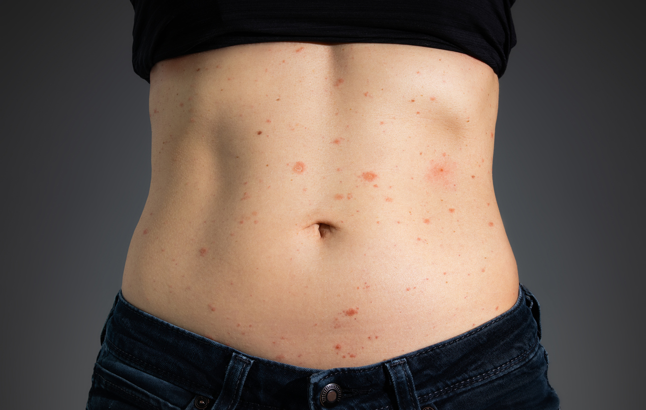 FOTO: iStock