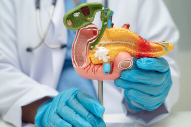 iStock