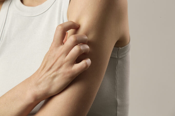 Foto: iStock